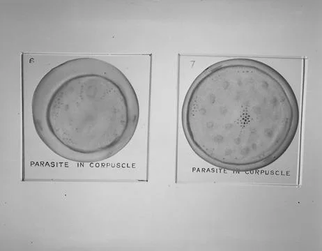 Malaria, USA Stock-Fotos