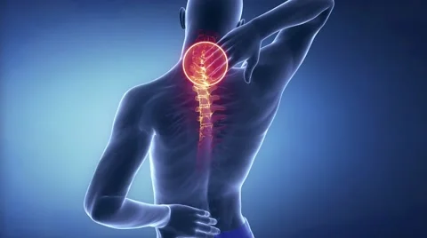 Male cervical  backbone pain - spine hurt concept Stock Footage
