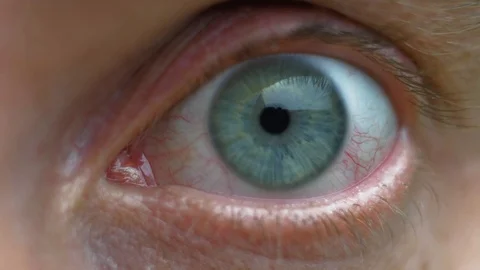 Male Congested Eye Looking into Camera Close-up Stock Footage 119452452