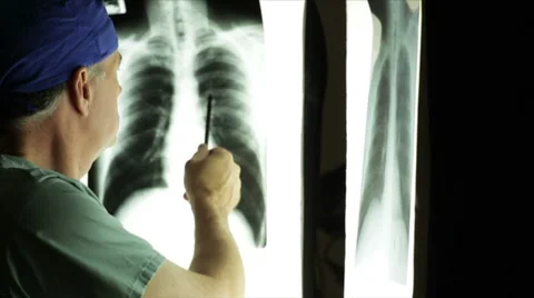 Male doctor looking at xray Stock Footage