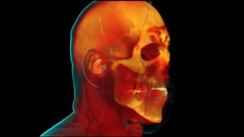 Male Head, Sagittal Section Stockbeeldmateriaal 86213830