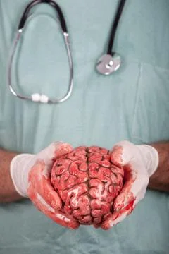 Male Surgeon Holding Brain Foto stock