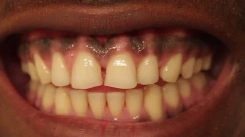 Male Teeth, Close Up Stock Footage 50622194