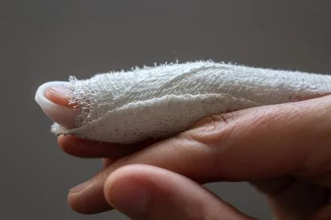 Mallet finger, stack splint on the middle finger with bandage to immobilize.. 스톡 사진