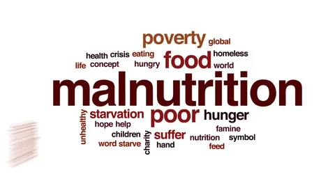 Malnutrition animated word cloud, text design animation. Stock Footage 78056874