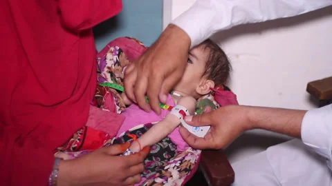 Malnutrition Stock Footage 202066154