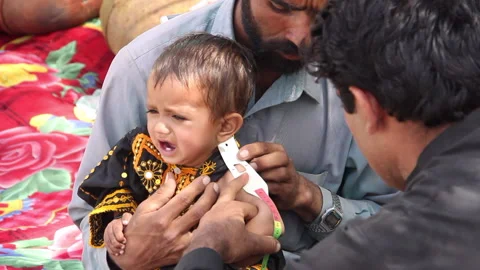 Malnutrition Stock Footage 202066373