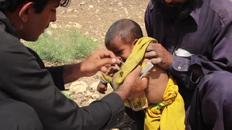 Malnutrition Stock Footage 202066604