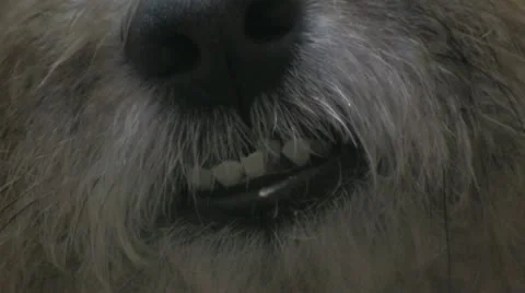 Malocclusion Vídeo Stock 10900892