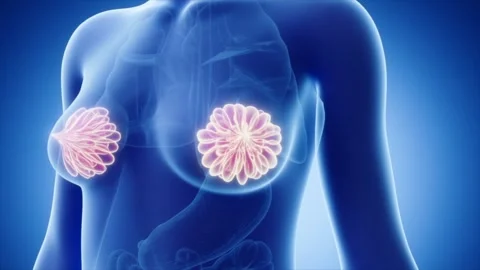 Mammogram to examine breast hyperplasia, breast cancer Vidéo 345016363