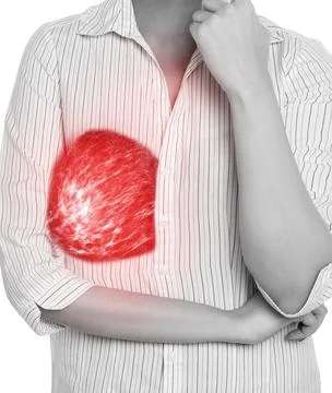 Mammogram image on the Right side  chest of woman. Stock Photos