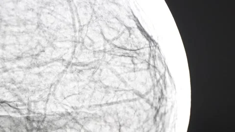 Mammography of the breast tissue. Video stock 306397161