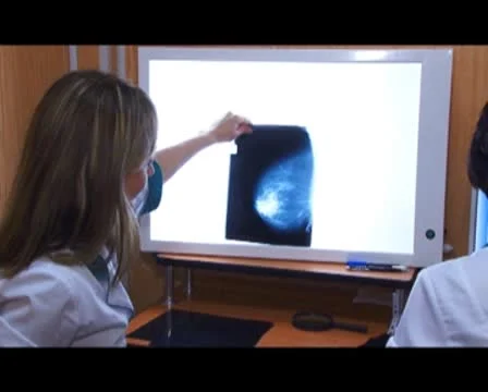 Mammography Stock-Footage 8917930