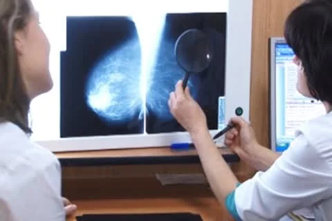 Mammography Stock-Footage 8917976