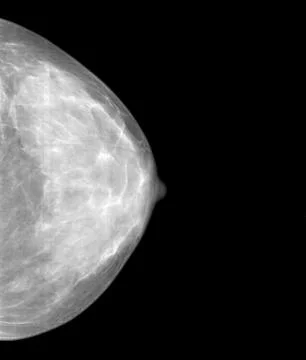 Mammography Fotos Stock