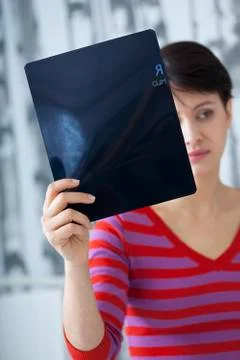 Mammography result Stock Photos