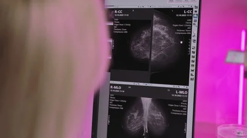Mammography Screening Results Displayed Stock Footage 311957932