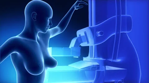 Mammography in x-ray view Stock Footage 25208587