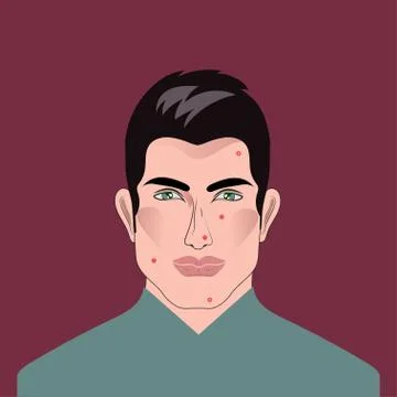 Man with acne, pimples Stock Illustration