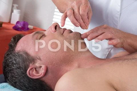 Man In An Acupuncture Therapy At The Health Spa