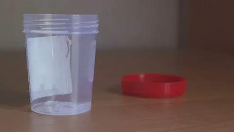 Man with the analysis of semen. Sperm donation at the clinic. concept of Видео 90150207