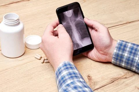 Man analyzing digital CT scan of his lungs at home Stock Photos