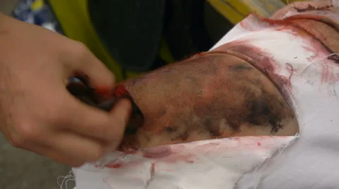 Man applied makeup on her knee, filming, actor training Video stock 68209222