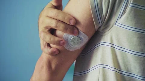 A man applies a sensor Stock Footage 314112403