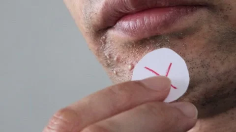 A man applying cross-linking to rough skin Stock Footage 326087307