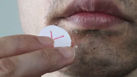 A man applying cross-linking to rough skin 動画素材 326087379