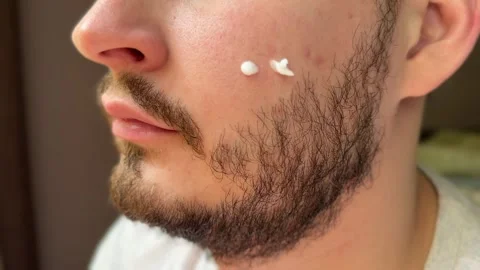 Man applying face cream to cheek and rubbing it in Stock-Footage 311313959