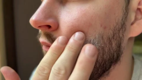 Man Applying White Face Cream at Home Close-Up Stock Footage 311313941