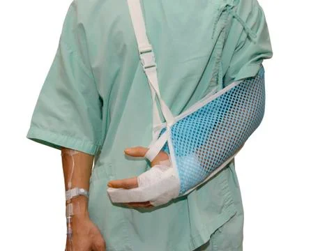 Man with an arm in plaster Stock Photos