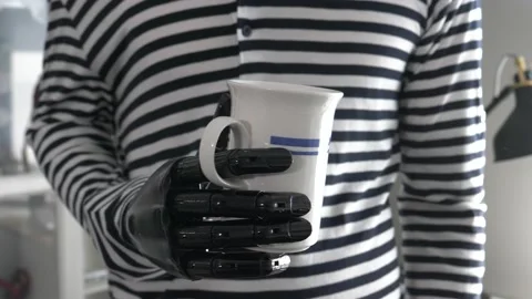 Man With Artificial Prosthetic Hand Holding a Cup and Drinking Stock Footage 135697093