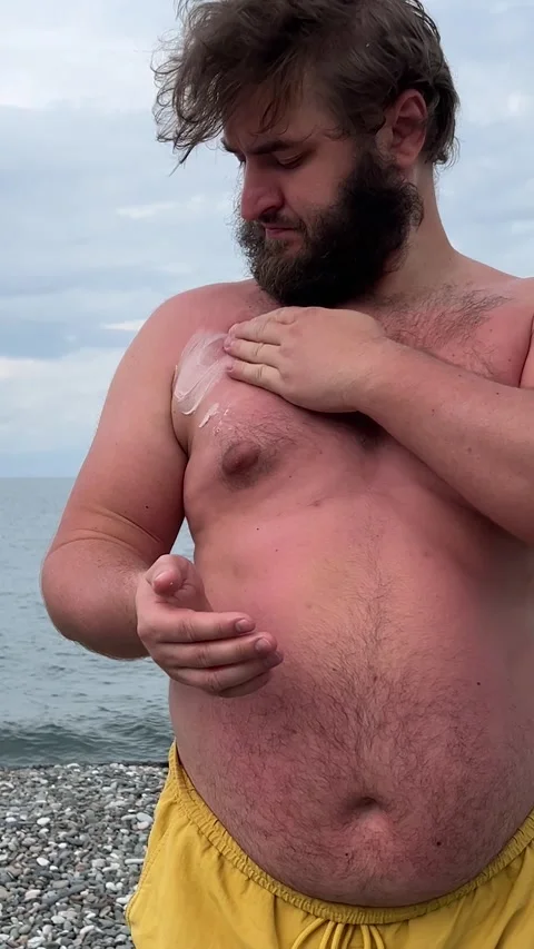 Man with beard, big belly in yellow shorts applies cream to his body on beach Stock Footage 329666773