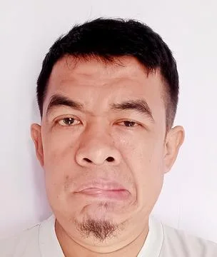 A man with bell palsy 写真素材