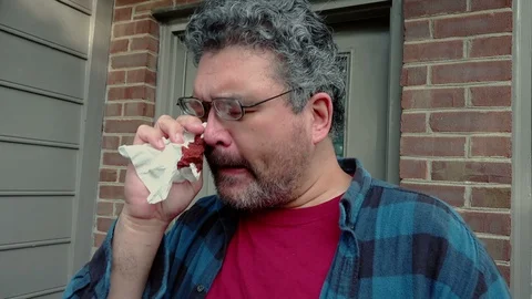 Man with a bloody nose after a fight Stock Footage