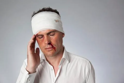 A man with bruises, a bloody nose and a bandhead Stock Photos