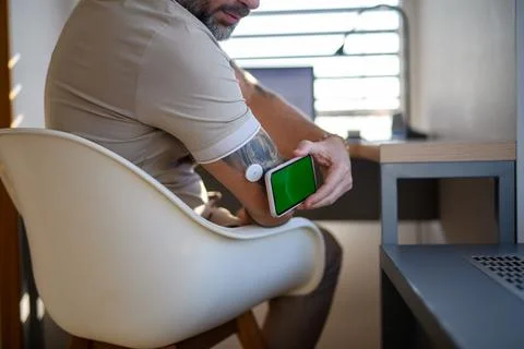 Man with CGM sensor is checking blood glucose level using smartphone app. 写真素材