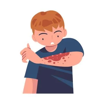 Man Character with Skin Problem Suffering from Itching Arm Vector Illustration Stock Illustration