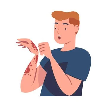 Man Character with Skin Problem Suffering Scratching Itching Arm Vector Stock Illustration