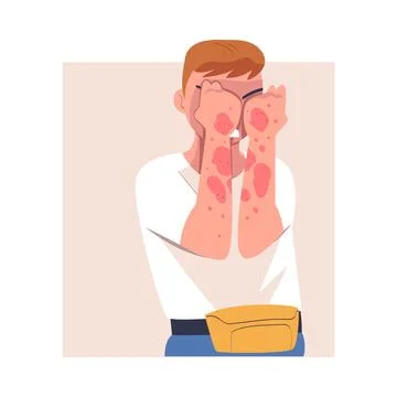 Man Character with Skin Problem Suffering from Itching Arms Vector Illustration Stock Illustration