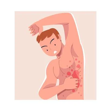 Man Character with Skin Problem Suffering Scratching Itching Body Vector Stock Illustration