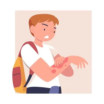 Man Character with Skin Problem Suffering Scratching Itching Arm Vector Stock Illustration