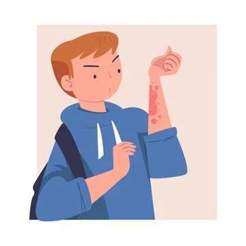 Man Character with Skin Problem Suffering Scratching Itching Arm Vector Stock Illustration