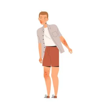Man Character Suffering from Neurodermatitis Having Itchy Skin Covered with Red Stock Illustration