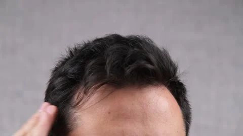 Man checking hair loss Stock Footage 260636696