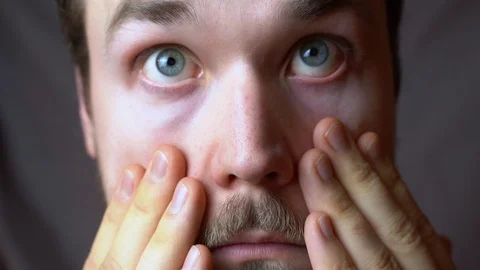 A man checks the dark circles under the eyes Stock-Footage 124262523