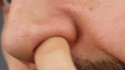 Man clean up or picks his nostril, scratches his itchy nose, close-up side view Video stock 145535983