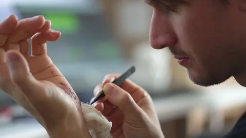 Man cleaning a bleeding wound under the skin after the accident. Treatment and Stock Footage 134490057
